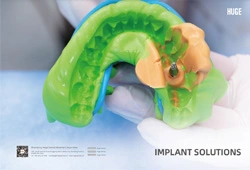 Solution d'implant énorme