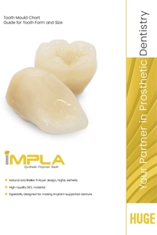 Graphique du moule IMPLA
