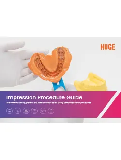 HUGE PERFIT Guide d'impression et dépannage