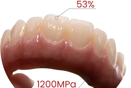 Prêt pour arc complet. Esthétique incluse.  Voir la zircone MM-4D dans des cas cliniques réels.